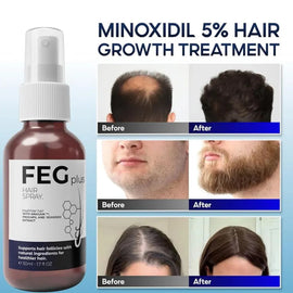 FEG Plus Hair Growth Spray (Original) Emiraa