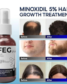 FEG Plus Hair Growth Spray (Original) Emiraa