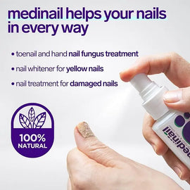 Jaysuin™ - Nail Fungus Spray (Original) Emiraa